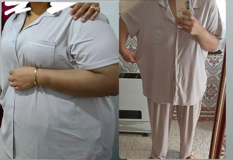 قبل وبعد — عضوة في المتابعة
